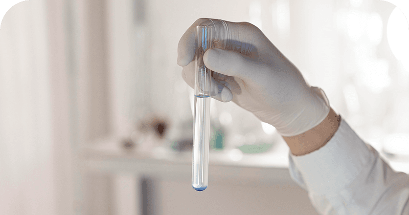 Lab Tests