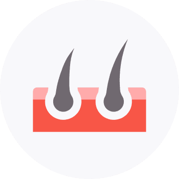 Hair Loss | Apka Muaalij