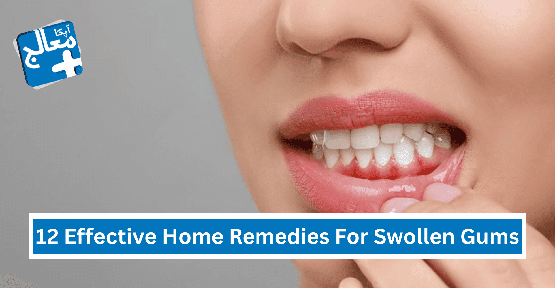 12 Easy & Effective Home Remedies For Swollen Gums | Apka Muaalij 12 Easy & Effective Home Remedies For Swollen Gums | Apka Muaalij