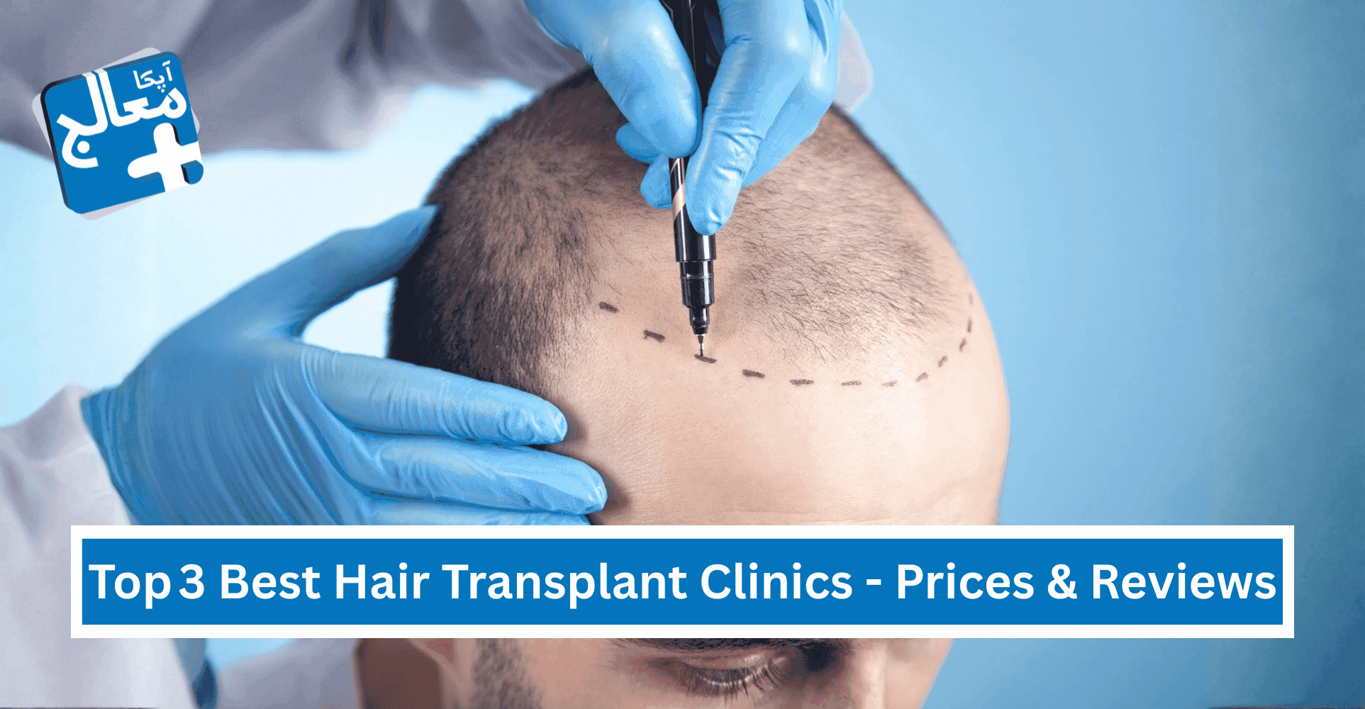 Top 3 Best Hair Transplant Clinics - Prices & Reviews | Apka Muaalij Top 3 Best Hair Transplant Clinics - Prices & Reviews | Apka Muaalij