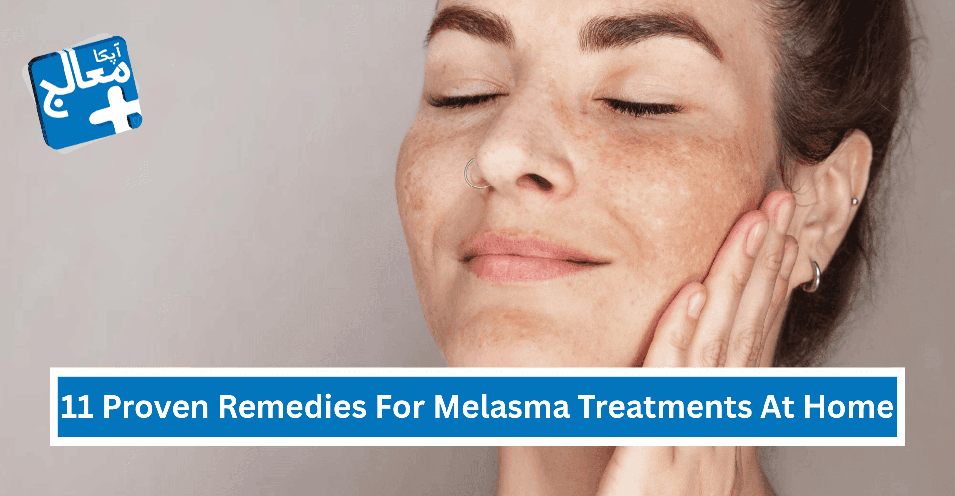 Apka Muaalij | 11 Proven Remedies For Melasma Treatments At Home