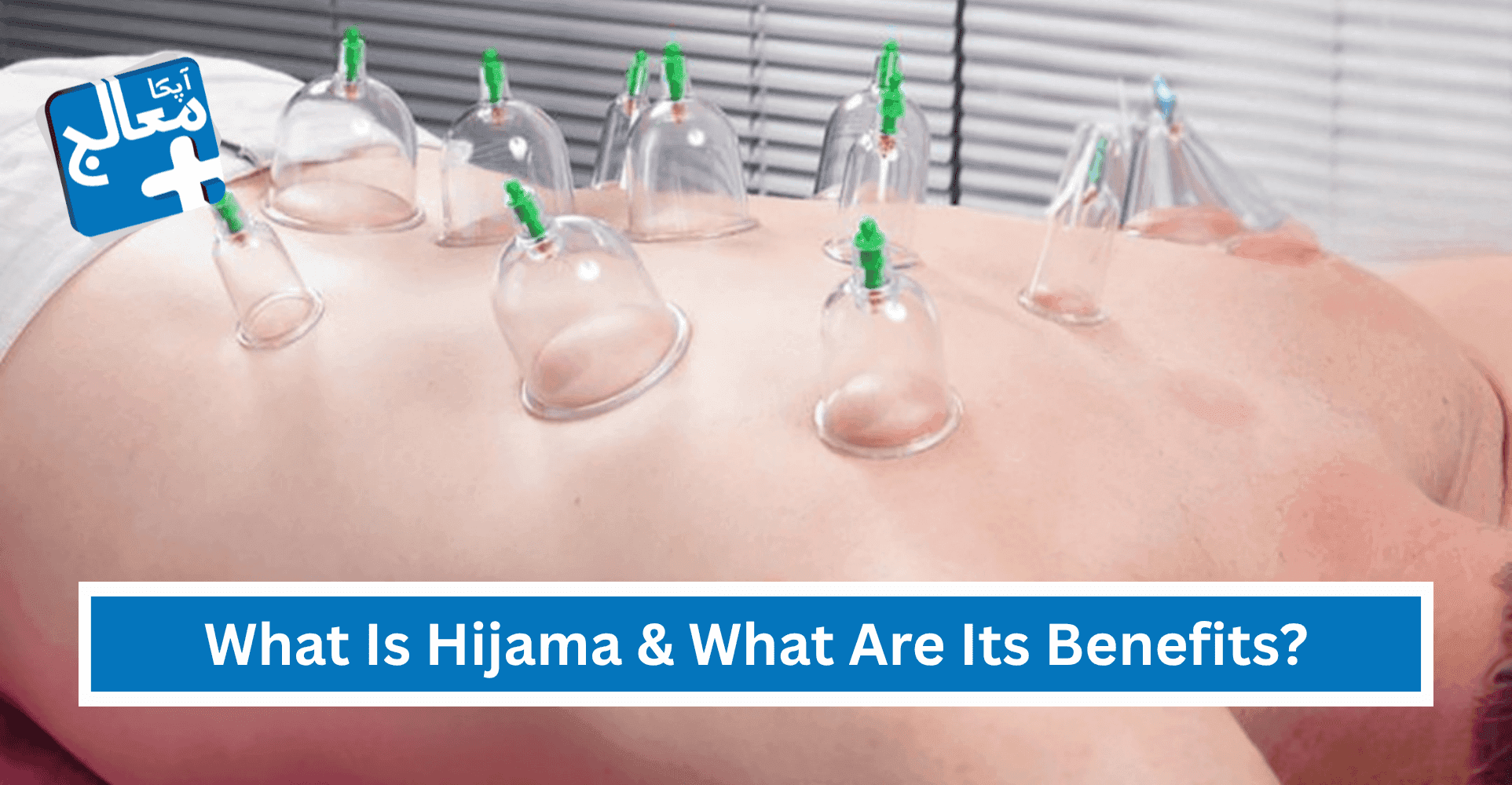 What Is Hijama & What Are Its Benefits? | Apka Muaalij What Is Hijama & What Are Its Benefits? | Apka Muaalij