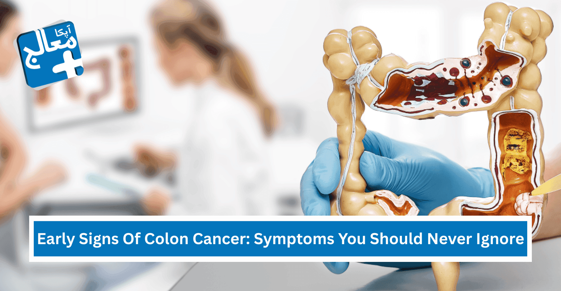 Early Signs Of Colon Cancer: Symptoms You Should Never Ignore | Apka Muaalij Early Signs Of Colon Cancer: Symptoms You Should Never Ignore | Apka Muaalij